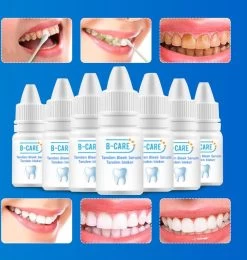 B-care Tanden Bleker – Wittere Tanden – Teeth Whitening Strips – Professioneel Resultaat - Tandsteen Verwijderaar - Zonder Peroxide - Tandenbleekset - Tanden Bleken -Mondverzorging 1138x1200 6