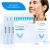 ISmile Professionele Tandenbleekset - Veilig Tanden Bleken - Zonder Peroxide - Witte Tanden - Teeth Whitening