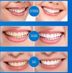 B-care Tanden Bleekpen - Teeth Whitening Pen - Tanden Bleker - Wittere Tanden - Teeth Whitening Strips - Professioneel Resultaat - Tandsteen Verwijderaar - Zonder Peroxide - Tandenbleekset - Tanden Bleken -Mondverzorging 1170x1200 5