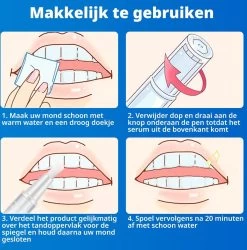 B-care Tanden Bleekpen - Teeth Whitening Pen - Tanden Bleker - Wittere Tanden - Teeth Whitening Strips - Professioneel Resultaat - Tandsteen Verwijderaar - Zonder Peroxide - Tandenbleekset - Tanden Bleken -Mondverzorging 1185x1200 2