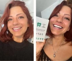 Love2smile PAP+ Premium Strips - Whitening Strips - De Natuurlijke Tandenbleker Van Nederland & België - Goedgekeurde Tandenbleek Strips - Teeth Whitening Strips - Wittere Tanden - Zonder Peroxide -Mondverzorging 1200x1023