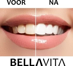 BELLAVITA Tandenbleekset - Tanden Bleken - Teeth Whitening Kit - Tandenblekers - 4 Gelpennen - Zonder Peroxide - 100% Natuurlijk - Witte Tanden -Mondverzorging 1200x1095 2
