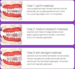 Edoir Rechte Tanden Beugel - Retainer Voor Rechte Tanden - Rechte Tanden Bitje -Mondverzorging 1200x1109 1