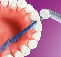 Philips Sonicare AirFloss Ultra HX8032/07 - Spuitkoppen Voor Tussen De Tanden 20 Philips Sonicare AirFloss Ultra HX8032/07 - Spuitkoppen Voor Tussen De Tanden -Mondverzorging 1200x1131 7