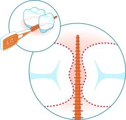 Tepe EasyPick Paars Maat XL – 36 Stuks -Mondverzorging 1200x1146 2