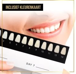 The Million Dollar Smile® Tandenbleekset Geschikt Voor Gevoelige Tanden - Zonder Peroxide (0%) - Wittere Tanden - 100% Natuurlijk - Tanden Bleken - Tandenblekers - Teeth Whitening Kit - Geen Gevoelige Tanden -Mondverzorging 1200x1169 5