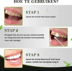 Teeth Whitening Serum Met 10 Wattenstaafjes - Tandenbleker - Teeth Whitening Strips - Tanden Witten - Tandenblekers - Witte Tanden - 10ml - Valentijnsdag Cadeau -Mondverzorging 1200x1170 2