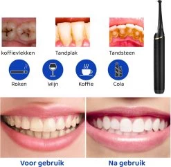 ExCorn Elektrische Tandsteen Verwijderaar - Inclusief 6-delig Tandartsset - 3 Standen - Elektrisch Tandplak Verwijderen - Tanden Polijsten -Mondverzorging 1200x1173 2