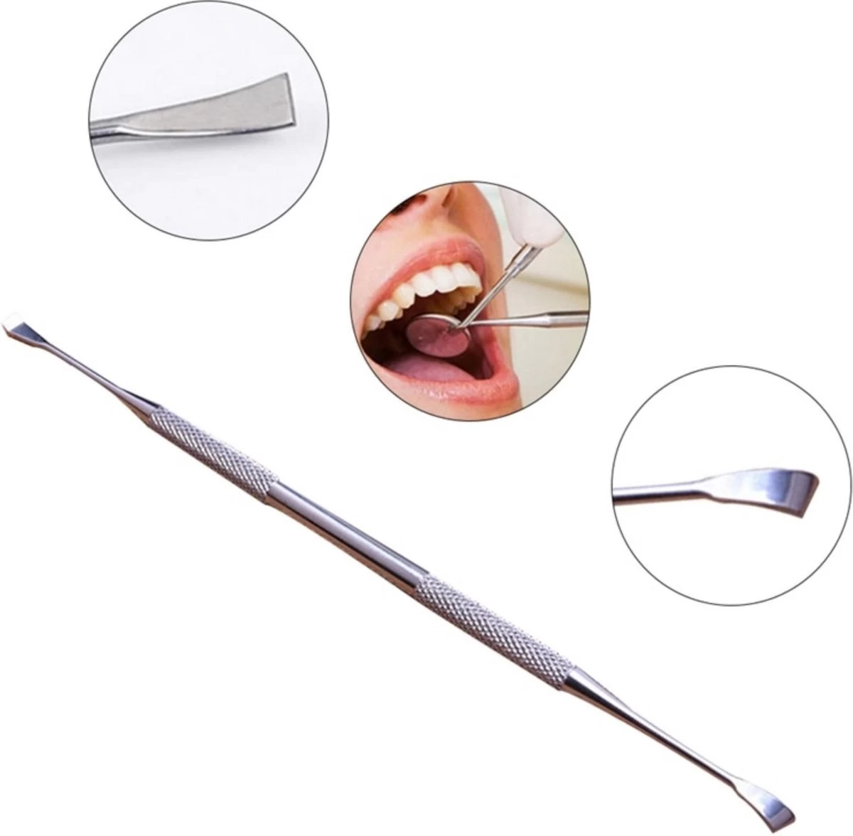 Merkloos Zelf Tandsteen En Plak Verwijderen Met Deze Tandsteen Schraper 3 Merkloos Zelf Tandsteen En Plak Verwijderen Met Deze Tandsteen Schraper