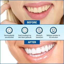 V-Goods Premium Whitening Strips - Tandenbleek Strips - Wittere Tanden - 28x Tandenbleek Strips DIRECT Resultaat - Tandenbleekset - Whitening - Tandenblekers -Mondverzorging 1200x1199 14