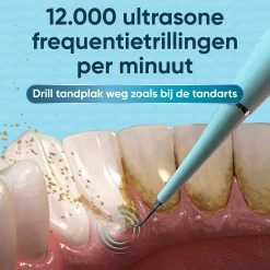 Whitee Elektrische Tandsteen Verwijderaar - Tanden Polijsten - Tandarts Tandsteenverwijderaars - Elektrisch Tandplak Verwijderen -Mondverzorging 1200x1200 1016