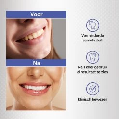 Merkloos Tanden Bleken Met 14 Sets Whitening Strips - Tandenbleekset Met Bamboe Tandenborstel - Tanden Bleekstrips -Mondverzorging 1200x1200 1052