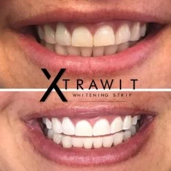 Xtrawit - Teeth Whitening Strips - Tandenbleekset - Wittere Tanden - Goedgekeurde Tandenbleek Strips - 30 Strips -Mondverzorging 1200x1200 1062