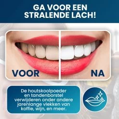 Tandenbleekset - Teeth Whitening - Teeth Whitener - Wittere Tanden - Tanden Bleken - Direct Resultaat - Zelfde Effect Als Whitening Strips -Mondverzorging 1200x1200 1072