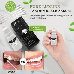 Teeth Whitening Serum Met 10 Wattenstaafjes - Tandenbleker - Teeth Whitening Strips - Tanden Witten - Tandenblekers - Witte Tanden - 10ml - Valentijnsdag Cadeau -Mondverzorging 1200x1200 1089