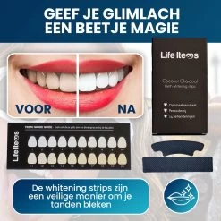 Tandenbleekset Voor Teeth Whitening Inclusief Gratis Whitening Strips - Wittere Tanden - Tanden Bleken - Frisse Adem - Tandsteen - Tandplak - Gele Tanden -Mondverzorging 1200x1200 1095