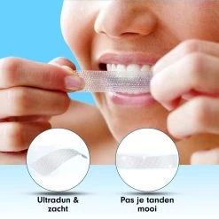 Diamond White - Teeth Whitening Strips - 28x Strips - Zonder Peroxide (0%) - Tandenbleekset - Tandenbleek Strips – Mint -Mondverzorging 1200x1200 1105