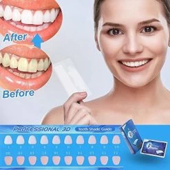 Merkloos Professionele Tanden Bleek Strips Ultra 3D - Teeth Whitening Strips - Tanden Bleken - Voor Ultra Witte Tanden - 14 Strips -Mondverzorging 1200x1200 1108
