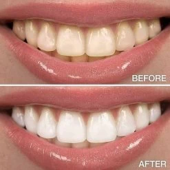 Perfect Wit - Whitening Pen - Tandenblekers - 100% Natuurlijke Ingrediënten - Peroxidevrij - Veilig Bleken - Witte Tanden - Tandbleekset - Tanden Bleken - Whitening - Teeth Whitening - Frisse Adem -Mondverzorging 1200x1200 1120