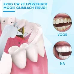 DEN-T® PRO P350 Elektrische Tandenpolijster - Wit - 5 Standen - 5 Opzetstukken - Polijstmachine - Polijstset - Tanden Polijsten - -Mondverzorging 1200x1200 734