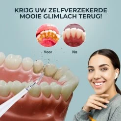 Merkloos Tandsteen Verwijderaar Elektrisch – Tandenborstel Opzetstukken - Tandarts Spiegel - 5 Standen -Wit 16 Merkloos Tandsteen Verwijderaar Elektrisch – Tandenborstel Opzetstukken - Tandarts Spiegel - 5 Standen -Wit -Mondverzorging 1200x1200 997