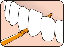 Tepe EasyPick Oranje Maat XS/S – 36 Stuks -Mondverzorging 1200x897 1