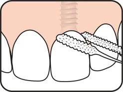 Tepe Floss Bridge & Implant 30 St 20 Tepe Floss Bridge & Implant 30 St -Mondverzorging 1200x899 6