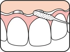 Tepe Floss Bridge & Implant 30 St 15 Tepe Floss Bridge & Implant 30 St -Mondverzorging 1200x901 1