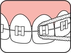 Tepe Floss Bridge & Implant 30 St 16 Tepe Floss Bridge & Implant 30 St -Mondverzorging 1200x902 2