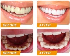 Colour Corrector - Paarse Tandpasta - Witte Tanden - Teeth Whitening - Purple Colour - Tandenbleekset -Mondverzorging 1200x963