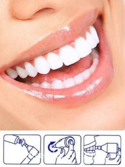 Merkloos HQ Tooth Polisher - Tanden Polijsten - Wittere Tanden - Tandsteen Tandplak Verwijderaar - Elektrisch -Mondverzorging 900x1200 5