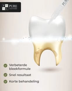 3x Navulling Tanden Bleekgel Spuiten ZONDER Peroxide - Refill Gel - Navulling - Veilig Tanden Bleken - Witte Tanden - Teeth Whitening - Valentijnsdag Cadeau -Mondverzorging 960x1200 17