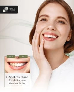 Tandenbleekset INCL. 14 Whitening Strips En 6 Gelpennen - ZONDER PEROXIDE - Teeth Whitening Kit - Tandenbleekset Met Ebook En Nederlandse Handleiding - Tandenblekers - Valentijnsdag Cadeau -Mondverzorging 960x1200 7